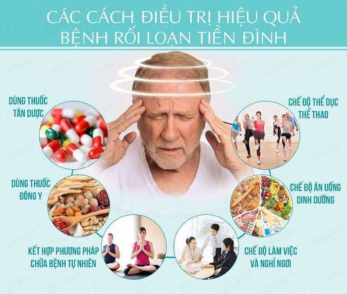 Điều trị rối loạn tiền đình như thế nào cho hiệu quả?